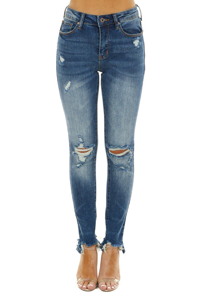 Dark Wash Mid Rise Skinny Jeans with Distressed Details 