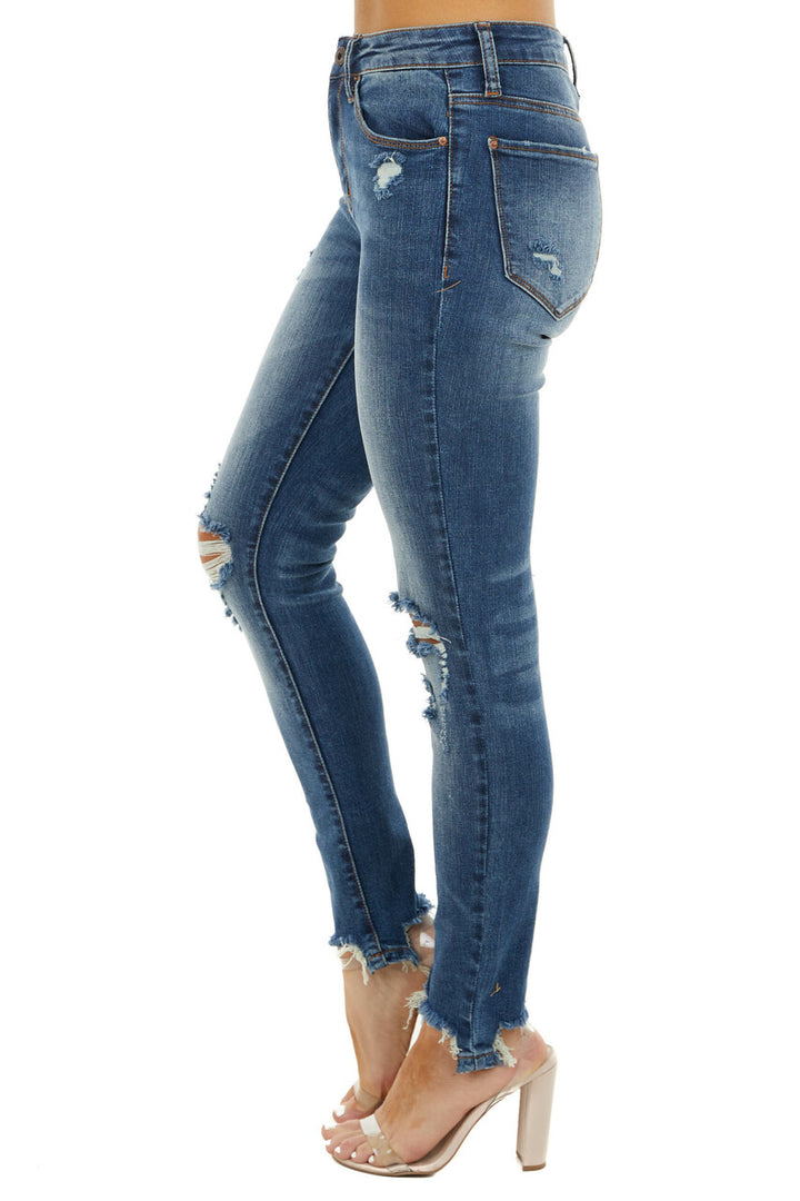 Dark Wash Mid Rise Skinny Jeans with Distressed Details 