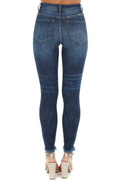 Dark Wash High Rise Skinny Jeans with Distressed Hemline